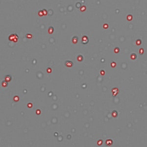 AOPI_Nuclei_Frozen_Rat_Lung