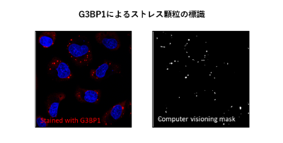 Stress_Granule_Labeling_by_G3BP1_and_Computer_Vision_Mask