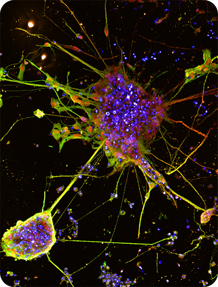 iPSC and brain-450px
