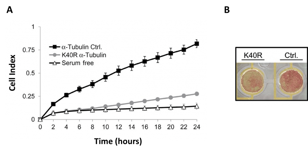migration-of-breast-cancer-cells-1024x506.png
