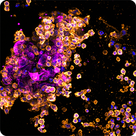 immuno-oncology-450px
