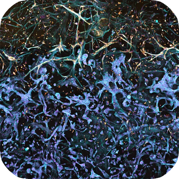 Cancer-Feature1-1_rounded_600px