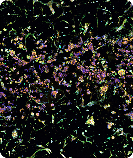 fibroblast-450px