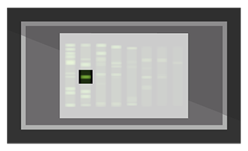 ddigit-band-excising_360px