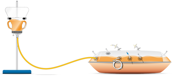 Inversion-Transfer-Cap-Illustration