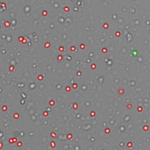 AOPI_Nuclei_Frozen_Mouse_Kidney