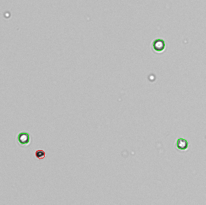 Trypan_MRC5