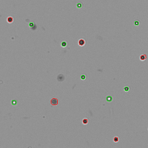 Trypan_Mouse_Lymph_Node