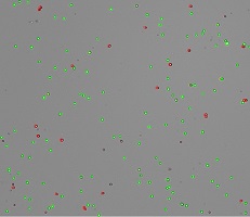 yeast-cells-counted